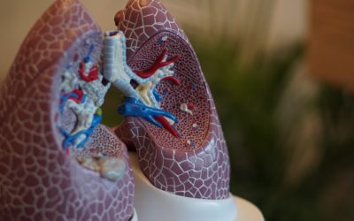 Mucoviscidose, bronches et poumons